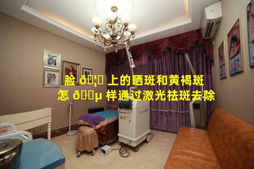 脸 🦊 上的晒斑和黄褐斑怎 🌵 样通过激光祛斑去除